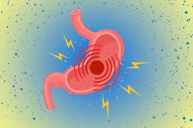 an illustration of a gut with pain